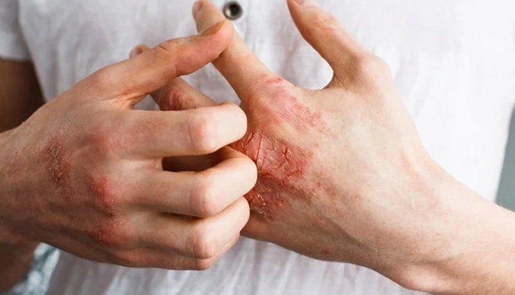 beauty benefits of using coconut oil,coconut oil,beauty tips,skin care tips