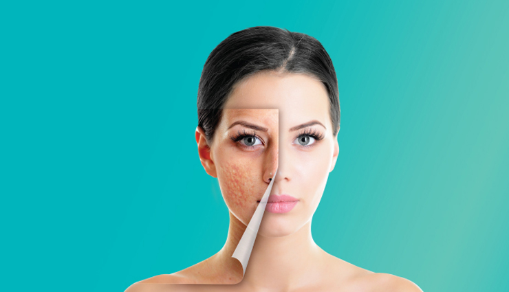 homemade coffee scrub,beauty benefits of homemade coffee scrub,skin care tips,beauty tips