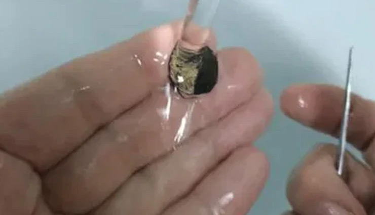 coin,coin removed from nose,weird news