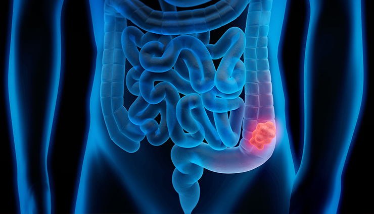 12 important health tests for women,essential health tests for women,womens health checkup list,crucial health screenings for women,top health tests for women,womens medical tests guide,health exams women must take,key health tests for women,womens preventive health tests,important womens health screenings