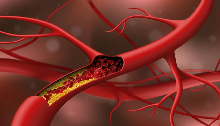 6 Remedies That Help To Control Cholesterol Level Naturally