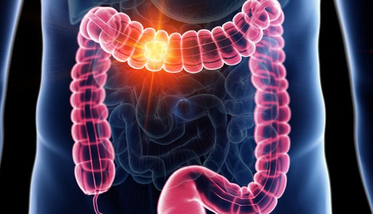 lesser-known benefits of cycling,hidden advantages of cycling,uncommon perks of cycling,cyclings surprising benefits,not-so-obvious advantages of cycling,underrated benefits of riding a bike,lesser-discussed benefits of bicycle riding,unconventional benefits of cycling,cyclings secret health benefits,little-known advantages of biking,surprising reasons to start cycling,health benefits beyond the pedal: cycling,lesser-explored advantages of cycling,cyclings unexpected perks,the hidden health benefits of cycling,why cycling is more beneficial than you think,exploring the less-publicized benefits of cycling,cyclings uncommon advantages,cyclings lesser-acknowledged health benefits,the surprising side of cycling: benefits you may not know