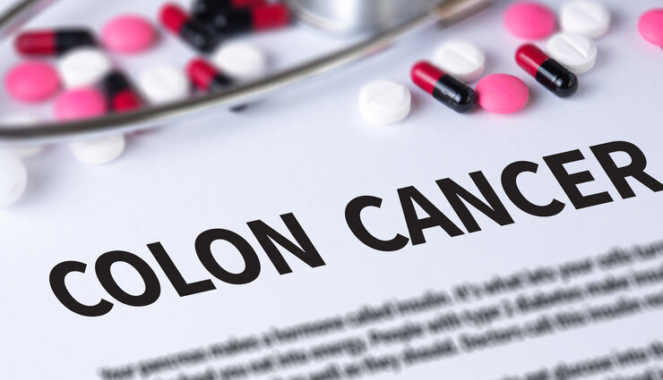 तुरंत छोड़ दें ये 10 चीजें खाना वरना सड़ जाएंगी आंतें, बनती है पेट के कैंसर की असली वजह colon cancer,foods causing colon cancer,colon cancer symptoms,colon cancer prevention tips,what is colon cancer,health news,Health tips,health news in hindi