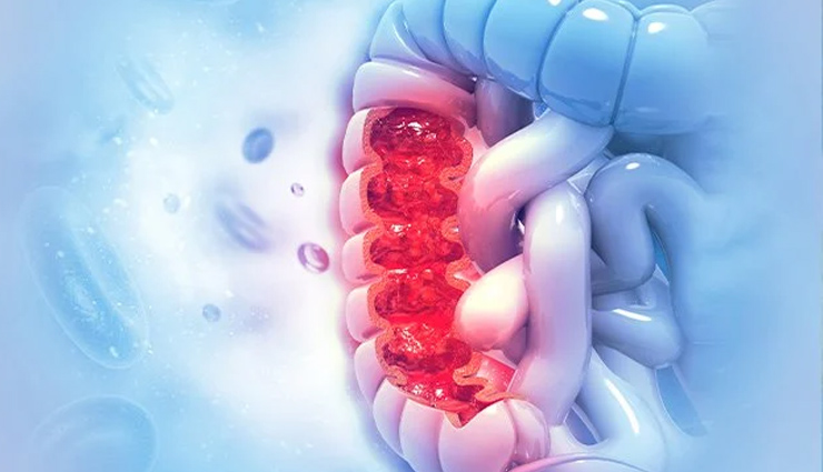 fart sound,stop fart,fart gas,fart volume,benefits of smelling fart,how to stop a fart from making noise,why do i fart so much,why do i fart so much and it smells