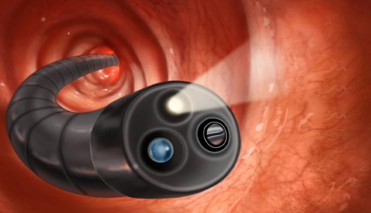 इन 5 बीमारियों का समय रहते करा लें स्क्रीनिंग टेस्ट, कहीं देर ना हो जाए Health tips,health tips in hindi,disease screening test,healthy life