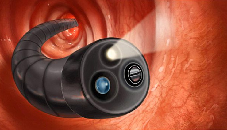 Health,health care tips,health care after 40,Health tips