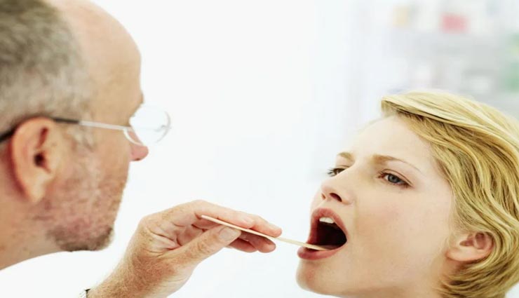 जीभ का रंग बनता हैं आपके स्वास्थ्य का दर्पण, जानें कैसे दर्शाता है बीमारी