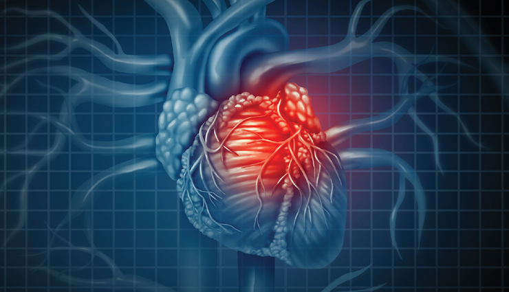 heart diseases,different type of heart diseases,heart care tips,heart care,heart condition,illness of heart,Health,Health tips