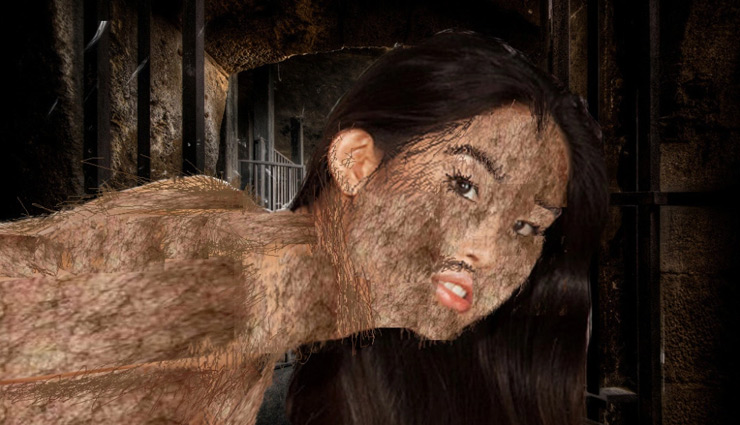 weird disease,hair grows all over body,congenital hypertrichosis