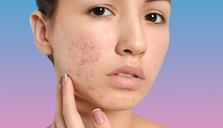 benefits of facial steaming for your skin,beauty tips,beauty hacks