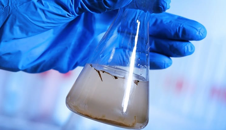 waterborne diseases,waterborne illness prevention,water contamination,safe drinking water,water treatment methods,waterborne pathogens,water quality testing,water filtration systems,water disinfection methods,waterborne illness symptoms and treatment