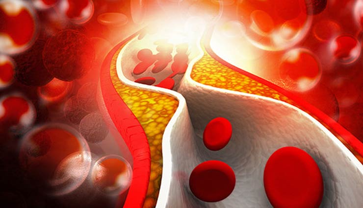 broccoli,broccoli benefits,broccoli health benefits,good health,healthy food,healthy diet,Health,Health tips,fights cancer,controls cholesterol,powerful antioxidant,aids in effective weight-loss,strengthens bones