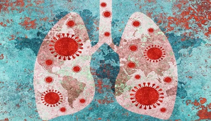 कोरोना रिसर्च : जिंदा रहने के लिए फेफड़े का प्रत्यारोपण ही होगा एकमात्र विकल्प