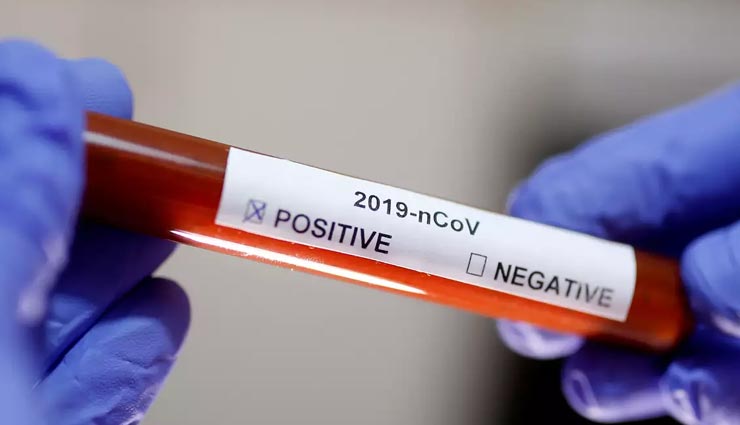 कोरोना को लेकर लापरवाही राजस्थान में पड़ रही भारी, मार्च महीने में 71 फीसदी बढ़े एक्टिव केस