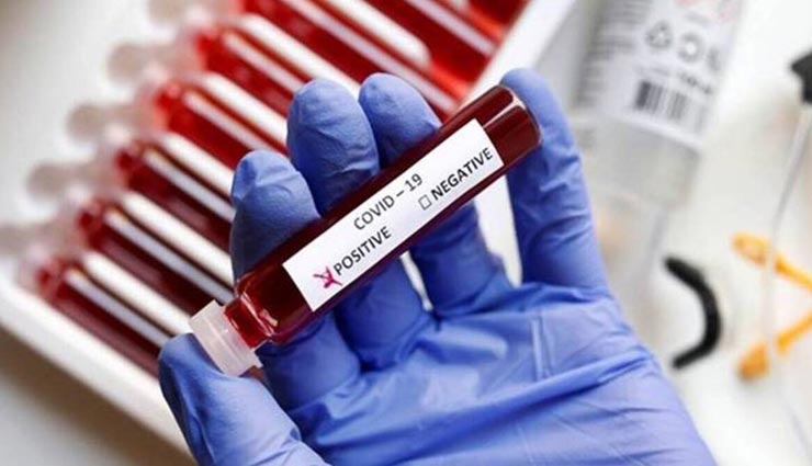 उदयपुर : बढ़ते संक्रमण की रफ्तार पर नहीं लग रहा अंकुश, बुधवार को फिर मिले 36 नए मरीज
