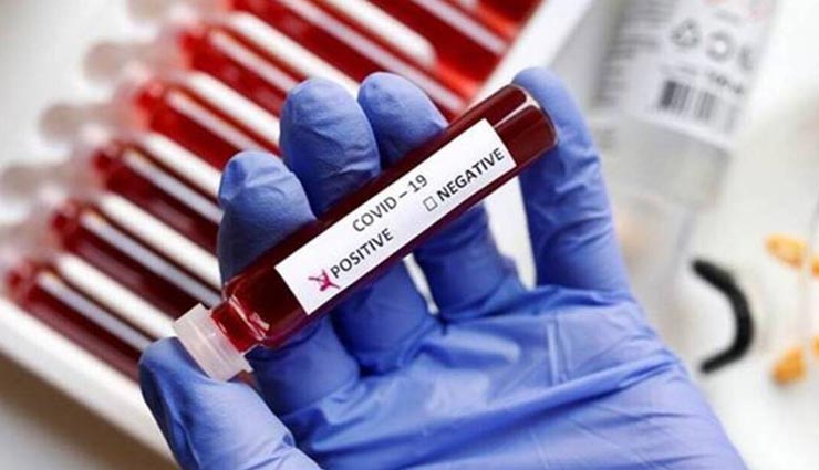 उदयपुर में कोहराम मचा रहा कोरोना, सामने आए 89 नए संक्रमित मरीज