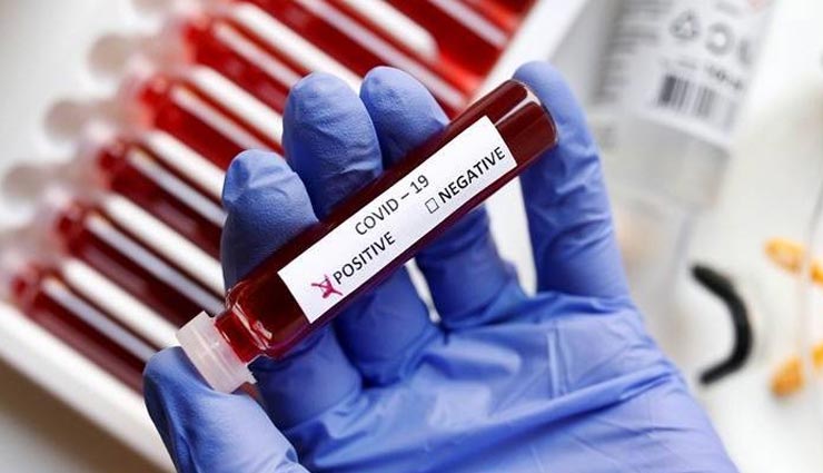 बीकानेर : नियंत्रण में नजर आ रही स्थिति, सुबह की रिपोर्ट में मिले 453 नए मरीज