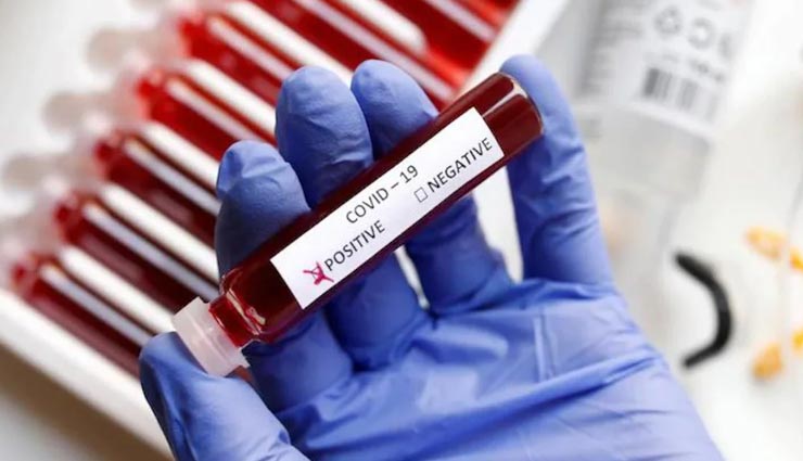 उत्तराखंड में लगातार गिर रहा कोरोना का आंकड़ा, नहीं हुई किसी भी मरीज की मौत