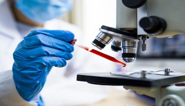 कोरोना मरीज और मौत का खतरा, ब्लड टेस्ट से अब चलेगा इसका पता