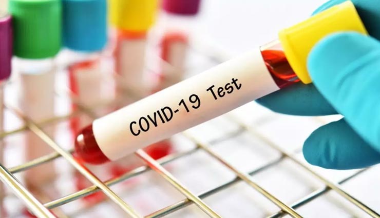 दिल्ली में आमजन को मिली राहत, सरकार ने घटाया आरटी-पीसीआर परीक्षण का खर्चा
