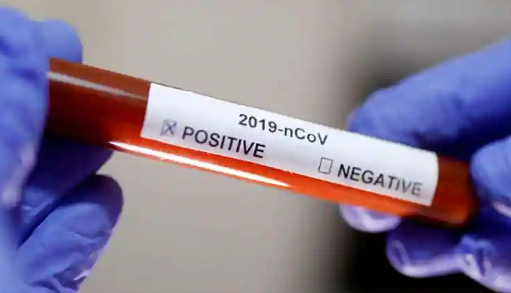 2 घंटे गलत लाइन में खड़ी रही कोरोना टेस्ट करवाने गई महिला, पैक करवाया चिकन और घर चल गई 