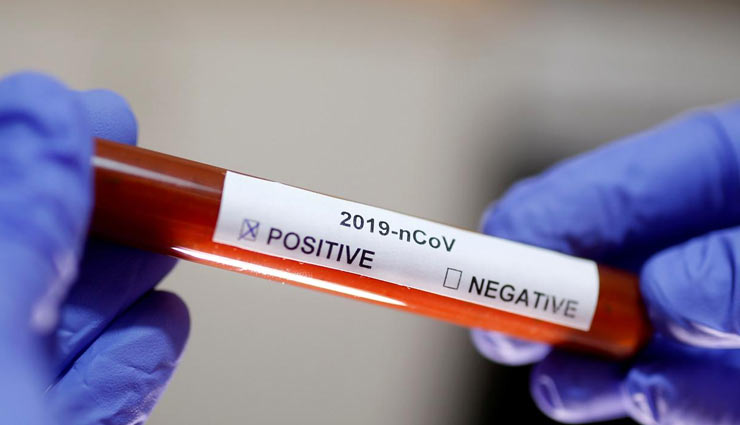 Coronavirus Update- Delhi doctor moves SC seeking modification of order for Free Coronavirus Testing