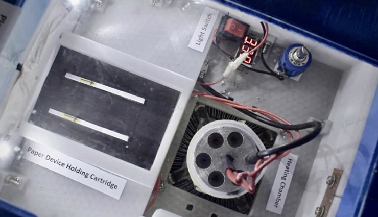 कोरोना टेस्टिंग की नई तकनीक का दावा, सिर्फ 1 घंटे में मिलेगी रिपोर्ट, खर्चा सिर्फ 400 रुपए