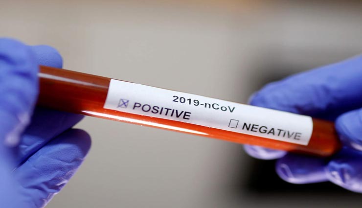 Health tips,health tips in hindi,covid 19,covid  patient treatment process,coronavirus