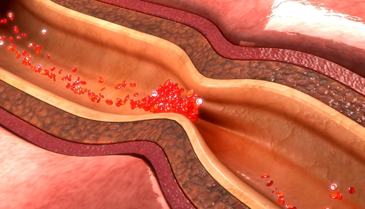heart diseases,different type of heart diseases,heart care tips,heart care,heart condition,illness of heart,Health,Health tips