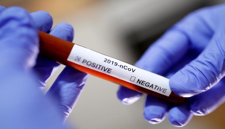 Health tips,health tips in hindi,health research,coronavirus,obesity and corona