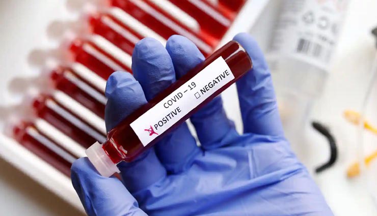 जयपुर : घटने लगा पॉजिटिव मरीजों का ग्राफ, मिले 2338 संक्रमित, 37 लोगों की हुई मौत