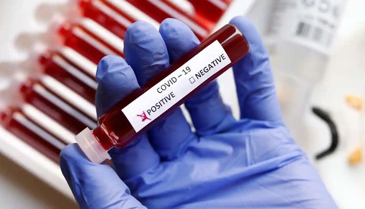 जोधपुर : थमने की ओर अग्रसर है कोरोना की दूसरी लहर का उफान, 323 नए संक्रमित, 1291 हुए ठीक