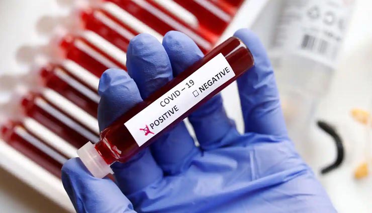 उदयपुर : रविवार का दिन रहा सबसे कम संक्रमण वाला, 124 दिन बाद सबसे कम 0.59% संक्रमण दर