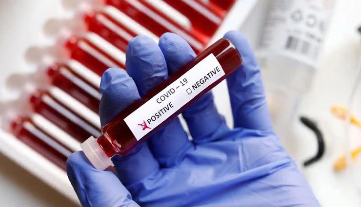 उदयपुर : 1 फीसदी से भी नीचे आ गई कोरोना संक्रमण दर, 590 सैंपल में मिले 13 रोगी 