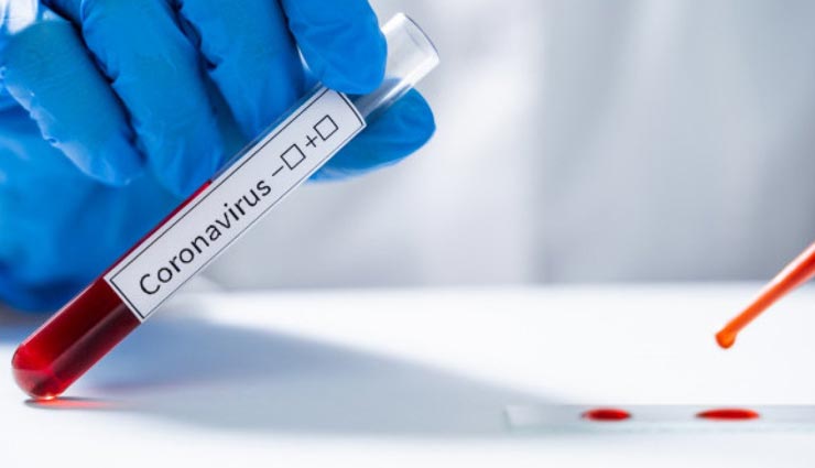 बीकानेर : एक बार फिर बढ़ा संक्रमितो का आंकड़ा, सुबह की रिपोर्ट में ही मिले पांच पॉजिटिव