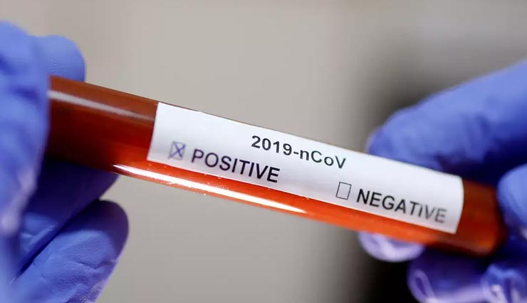 उत्तराखंड में आज फिर हुई कोरोना से एक मौत, 22 नए संक्रमितो से बढ़े एक्टिव केस