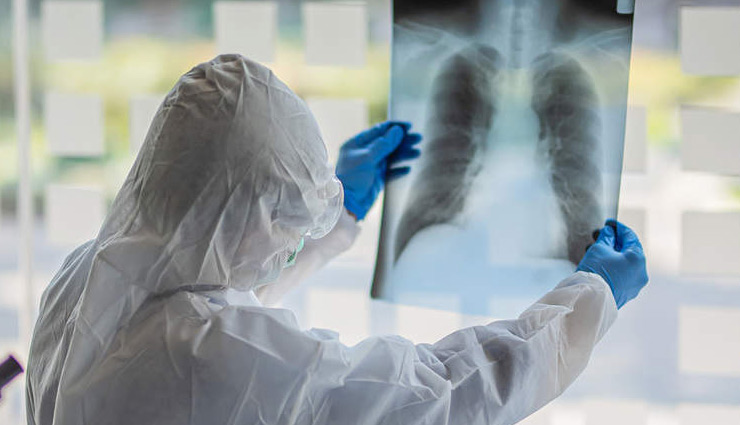 इस तरह बिना किसी दवा के भी हो सकता है कोरोना का इलाज, शोध में खुलासा