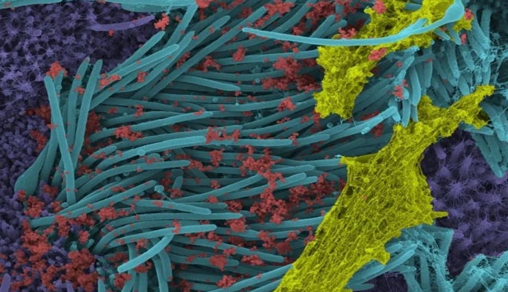सामने आई कोरोना संक्रमित कोशिका की तस्वीरें, वैज्ञानिकों ने की जारी