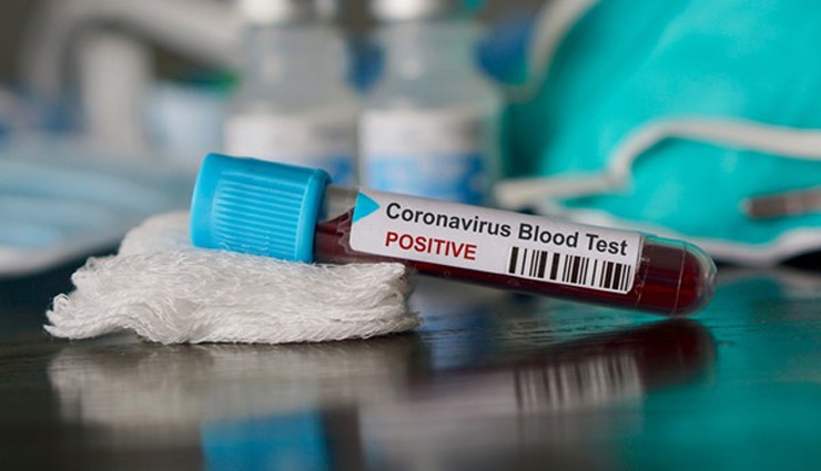 Shimla News: वैक्सीन की पहली डोज लगाने के 10 दिन बाद IGMC के 3 डॉक्टर हुए कोरोना संक्रमित 