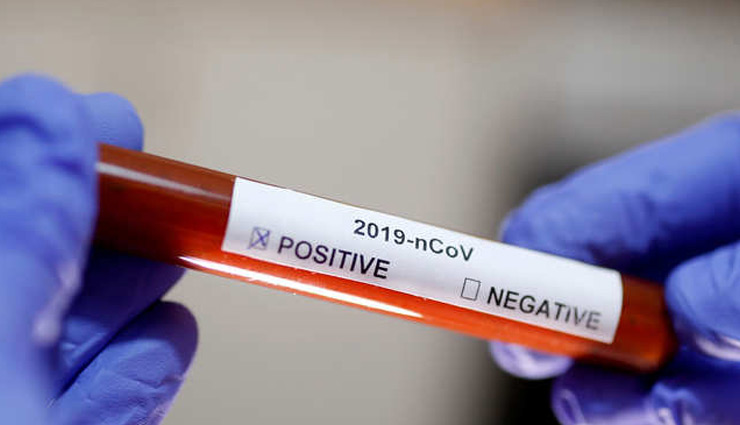 जानिए प्राइवेट लैब में कितने रूपये में होता है कोरोना वायरस टेस्ट, सरकार ने जारी किए दिशानिर्देश