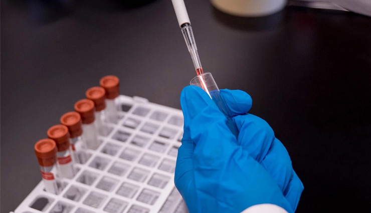 टाटा ग्रुप ने पेश किया देश का पहला CRISPR COVID-19 Test Kit,  सस्ता और कम समय में देगा सटीक जानकारी