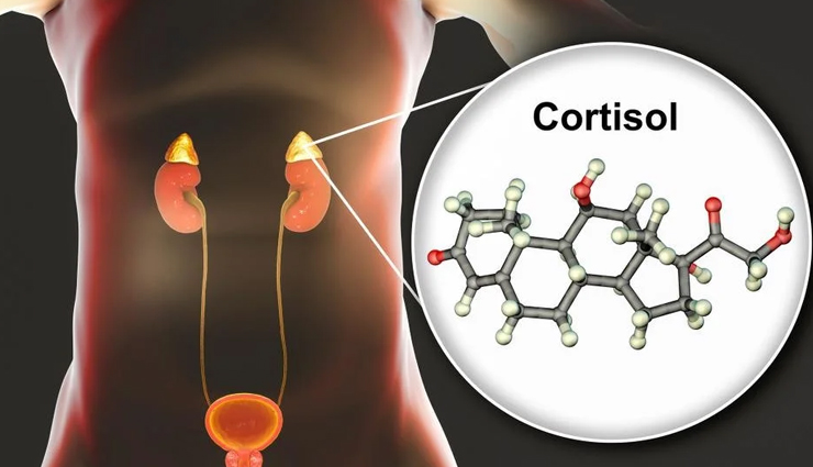 कहीं आप भी तो नहीं करते ब्रेकफास्ट स्किप करने की गलती, जानें सेहत को होने वाले ये 10 नुकसान breakfast,breakfast for good health,healthy breakfast,healthy living,Health tips