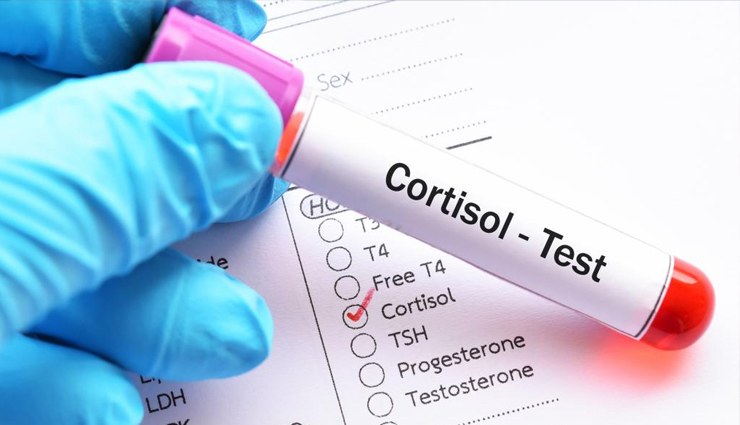 importance of ashwagandha,ashwagandha benefits,indian ginseng significance,uses of ashwagandha herb,ashwagandha in ayurveda,ashwagandha health benefits,adaptogenic herb ashwagandha,ashwagandha for stress relief,ashwagandha and immunity,ashwagandha for overall health