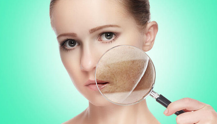 6 Effective Home Remedies for Cosmetic Allergy