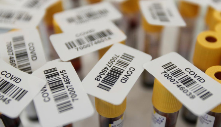 अमेरिकी कंपनी ने तैयार की एंटीबॉडी, कहा - कोरोना वायरस को रोकने में 100% कारगर