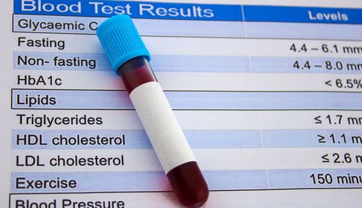 cowpeas health benefits,benefits of eating cowpeas,cowpeas nutrition advantages,cowpeas for health,health benefits of lobia,chawli nutritional benefits,cowpeas protein benefits,cowpeas vitamins and minerals,lobia health benefits,amazing benefits of cowpeas,cowpeas superfood benefits,cowpeas dietary advantages,cowpeas fiber content,chawli nutritional properties,lobia vitamins and minerals,health perks of eating cowpeas,cowpeas antioxidants,cowpeas for balanced diet,cowpeas micronutrients,health-boosting properties of cowpeas