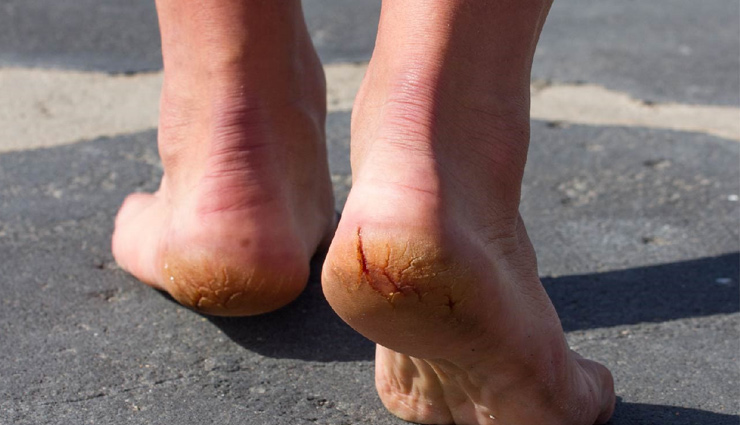 mint leaves for skincare,beauty benefits of mint leaves,mint leaves for glowing skin,mint leaves hair treatments,mint leaves natural remedies,mint leaves for acne,diy beauty with mint leaves,mint leaves face masks,mint leaves hair masks,mint leaves beauty tips