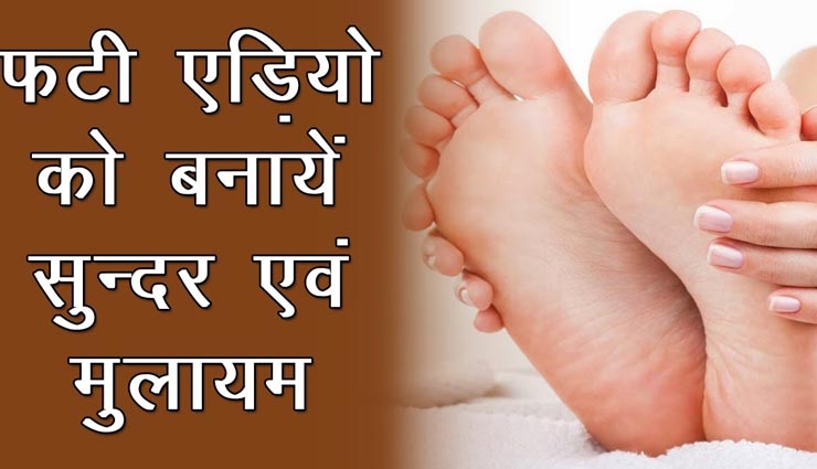 फटी एड़ियों को सुंदर और मुलायम बनाने के लिए आजमाए ये घरेलू उपाय