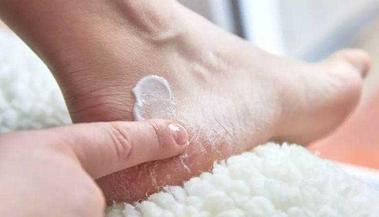 monsoon foot care tips,preventing foot infections during monsoon,keep feet healthy in rainy season,protect feet from monsoon infections,tips to avoid foot infections in monsoon,monsoon foot hygiene guide,prevent fungal infections in rainy season,best practices for foot care in monsoon,avoiding foot problems during rainy season,keep your feet infection-free this monsoon