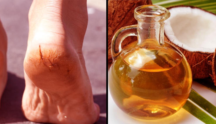 coconut oil,coconut oil for skin,coconut oil for hair,hair and skin benefits,coconut oil beauty benefits,coconut oil hair benefits